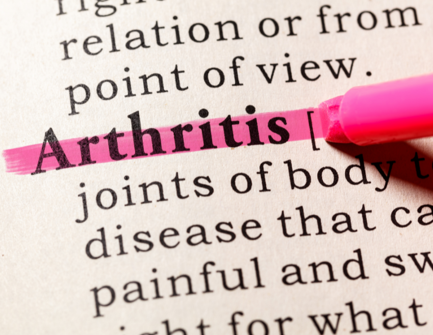 Arthritis and inflammation is one of the top reasons to use CBD
