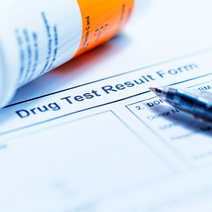 Does Delta 8 Cause a Drug Test to Fail